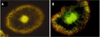 The Endophytic Strain <mark class="highlighted">Klebsiella michiganensis</mark> Kd70 Lacks Pathogenic Island-Like Regions in Its Genome and Is Incapable of Infecting the Urinary Tract in Mice